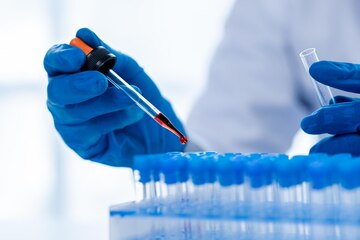 laboratory-assistants-are-investigating-chemical-reactions-medical-scientists-chemical-researchers-chemical-experiments-disease-testing-from-patient-blood-samples-medicine-research-concept_528263-4046.jpeg laboratory-assistants-are-investigating-chemical-reactions-medical-scientists-chemical-researchers-chemical-experiments-disease-testing-from-patient-blood-samples-medicine-research-concept_528263-4046.jpeg